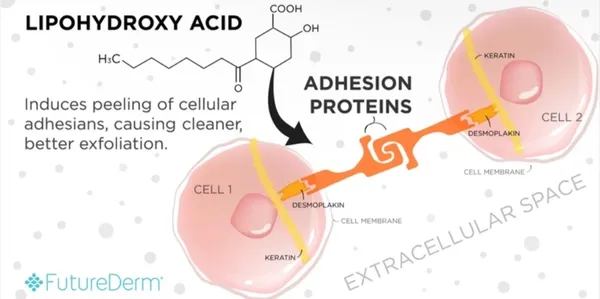 Hydroxy Acid and Alkali LHALA peel science information
